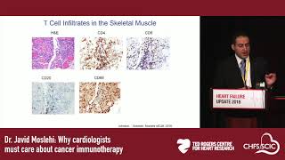 Dr Javid Moslehi Why cardiologists must care about cancer immunotherapy [upl. by Ennoryt584]