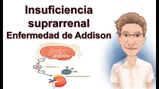 INSUFICIENCIA ADRENOCORTICAL ENFERMEDAD DE ADDISON [upl. by Elocal]