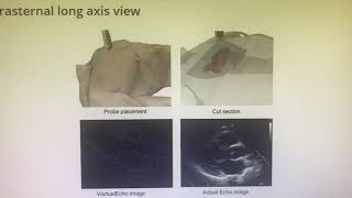 Basics of echocardiogram [upl. by Nerval744]