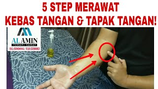 Urut Kebas Tangan amp Tapak Tangan  Carpal Tunnel Sindrom  01150404441 [upl. by Lemra]