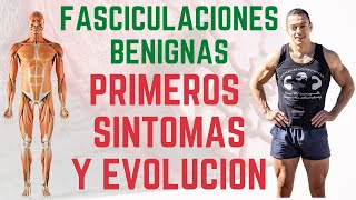 Fasciculaciones Benignas Primeros Síntomas y Evolución [upl. by Depoliti416]