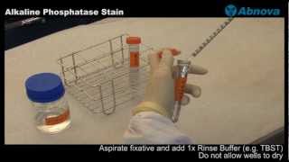 Alkaline Phosphatase Stain [upl. by Immot]