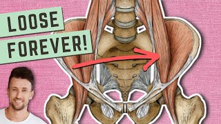 How to Permanently Loosen a Tight Psoas Hidden Cause Explained [upl. by Tare]