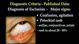 Fat Embolism Syndrome  Everything You Need To Know  Dr Nabil Ebraheim [upl. by Nosreg]