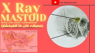 X Ray Mastoid Bone behind the ear in urduhindi कर्णमूल [upl. by Wendolyn488]