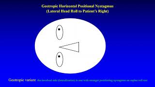 Geotropic and Apogeotropic Horizontal Positional Nystagmus [upl. by Cormac]