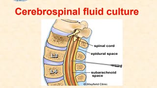 Cerebrospinal fluid culture  Micro Lab 2  Dr Ismail [upl. by Stasny]