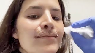 Pro Skater Brooklinn Khoury Shares Lip Reconstruction Progress 3 Years After Dog Attack [upl. by Gardie]