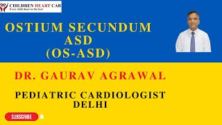 Ostium Secundum Atrial Septal Defect OSASD Dr Gaurav Agrawal Pediatric Cardiologist New Delhi [upl. by Ia]