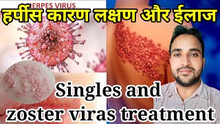 Singales हर्पीस के कारण लक्षण और ईलाजDiffrent between Shingles herpes and zoster herpes herpes [upl. by Ahtanoj]