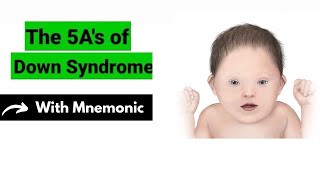 5 As Of Down Syndrome Mnemonic  Pediatrics Mnemonics  Dr Mubashar Ata [upl. by Nayarb325]