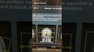 MRI Brain Scan diagnosticradiology mri radiology anatomy science breastimaging [upl. by Aiynat]