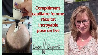 Complément Capillaire femme résultat incroyable [upl. by Ramaj374]