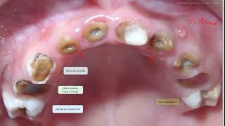 ODONTOPEDIATRIA  CLASE 1 Diagnostico [upl. by Virendra371]