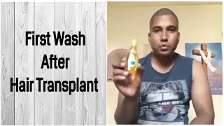 First Hair Wash After Hair Transplant [upl. by Tarrah]