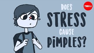 Does stress cause pimples  Claudia Aguirre [upl. by Grider]