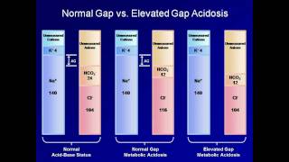 ABG Interpretation The Anion Gap Lesson 5 [upl. by Puglia]