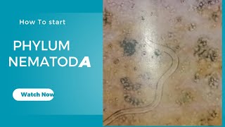 Phylum Nematoda Round worms Nematodes characteristics Invertebrates diversity Zoology [upl. by Liahkim]