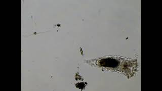 Diatom Becomes a Snack for a Rotifer [upl. by Aken287]