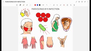 PARVOVIRUS B19 INFECTION [upl. by Yenttihw]