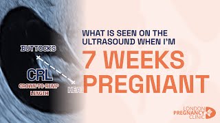 Week 7 Pregnant Ultrasound Babys Heartbeat amp Growth Shown [upl. by Nary]