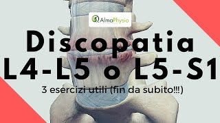 Discopatia L4L5 o L5S1 3 esercizi utili fin da subito [upl. by Dede]