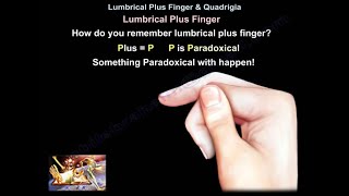 Lumbrical Plus Finger amp Quadrigia  Everything You Need To Know  Dr Nabil Ebraheim [upl. by Idel903]