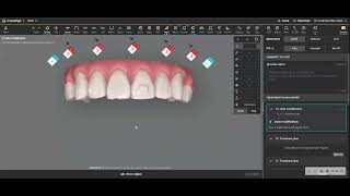 Limit root torque when possible [upl. by Tunnell]