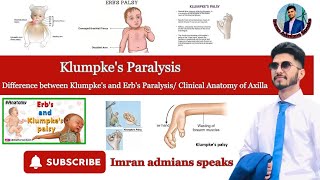 Klumpkes Paralysis  Differenc between Klumpkes and Erbs Paralysis  clinical anatomy of Axilla [upl. by Froemming55]