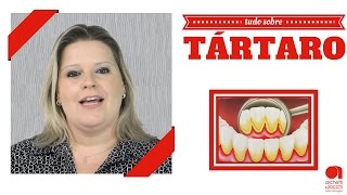 Tartaro Como acabar com o Tártaro nos Dentes [upl. by Lyon845]