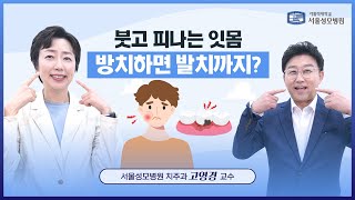 붓고 피나는 잇몸 방치하면 발치까지  서울성모병원 고영경 교수 [upl. by Rediah]