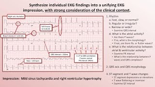 Intro to EKG Interpretation  The 5 Cardinal Rules [upl. by Einahets351]