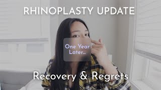 RHINOPLASTY PT 2 RECOVERY amp REGRETS [upl. by Ameen]