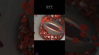 What is the DVT  Deep vein thrombosis [upl. by Norina514]