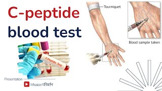 C Peptide test for diabetes  how to maintain C Peptide level in body [upl. by Alysoun]