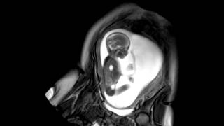 Foetal Development Unborn Baby Movement at 24 Weeks  WIRED [upl. by Llorre640]