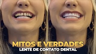 TUDO O QUE VOCE PRECISA SABER ANTES DE COLOCAR LENTES DE CONTATO DENTAL [upl. by Gnex]