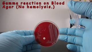 Gamma Reaction on Blood Agar [upl. by Cummings]