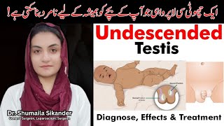 Undescended Testicle  Undescended Testis ka ilaj  Dr Shumaila Sikandar [upl. by Ztnaj]