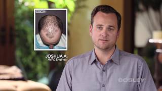 Bosley Hair Transplant Patient Review  Josh A [upl. by Tawney]