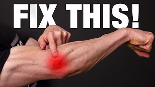 How to Fix Tennis Elbow PERMANENTLY [upl. by Nahtanod118]