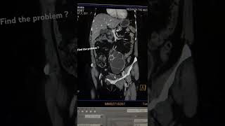 ct urography radiology ctscan [upl. by Magnuson]