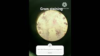 Gram staining Gram positive and Negative bacteria under microscopemicroscope science education [upl. by Vikki]