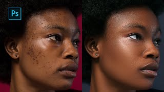 HighEnd skin Retouching Photoshop Tutorial  Frequency Separation [upl. by Miko]