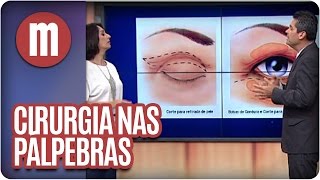 Mulheres  Saúde Cirurgia nas pálpebras 290316 [upl. by Rodrique]