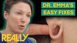 Dr Emma Has Easy Solutions To Incurable Problems  The Bad Skin Clinic [upl. by Henn]