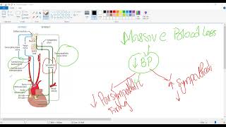 Baroreceptor reflexPostural hypotensioncardiology USMLE STEP 1 [upl. by Otreblasiul]