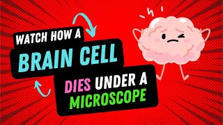 Brain Cell Death under the Microscope science biology [upl. by Vernier]