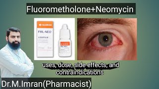 FML NEO eye drops are used in urdu  eye drops  Medicine information [upl. by Drhacir]