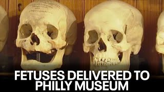 Package with 2 preserved fetuses received by Mutter Museum in Philadelphia [upl. by Ahsocin761]